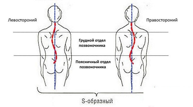 pozvonok-1 Сколиоз: степени, виды, причины, алгоритм коррекции | Доктор МАЗИТОВА  / Онлайн-школа здоровья