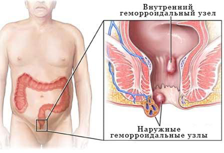 attachment-cc66a090 Статьи | Доктор МАЗИТОВА  / Онлайн-школа здоровья